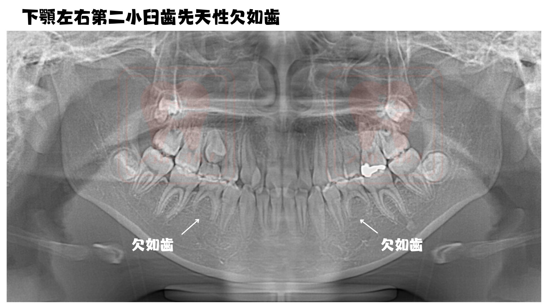 治療前