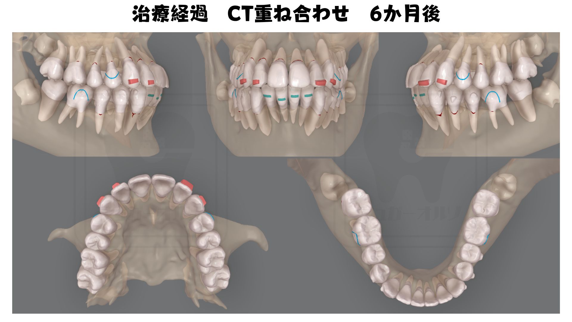 治療途中
